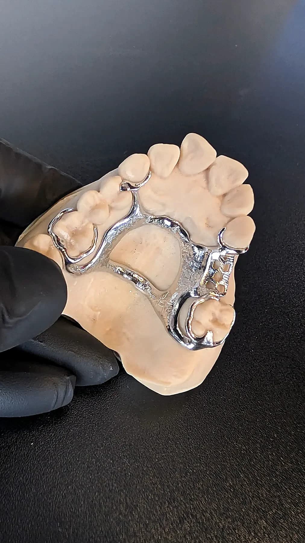 A polished upper cobalt-chrome framework seated on a dental model